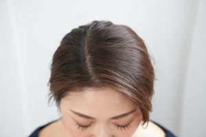 頭皮